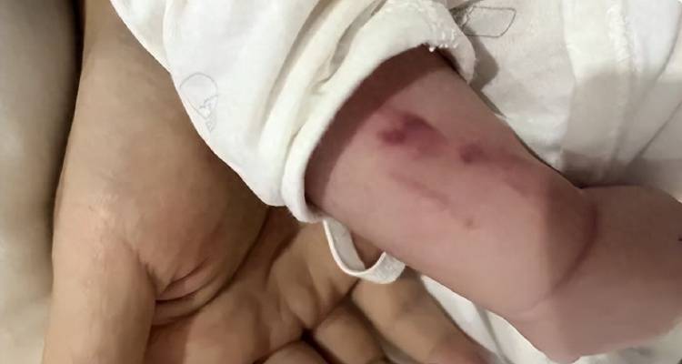 广西一男婴在月子中心被照料20天：身上2处骨折<strong></p>
<p>OBit</strong>，育婴室监控无法查看