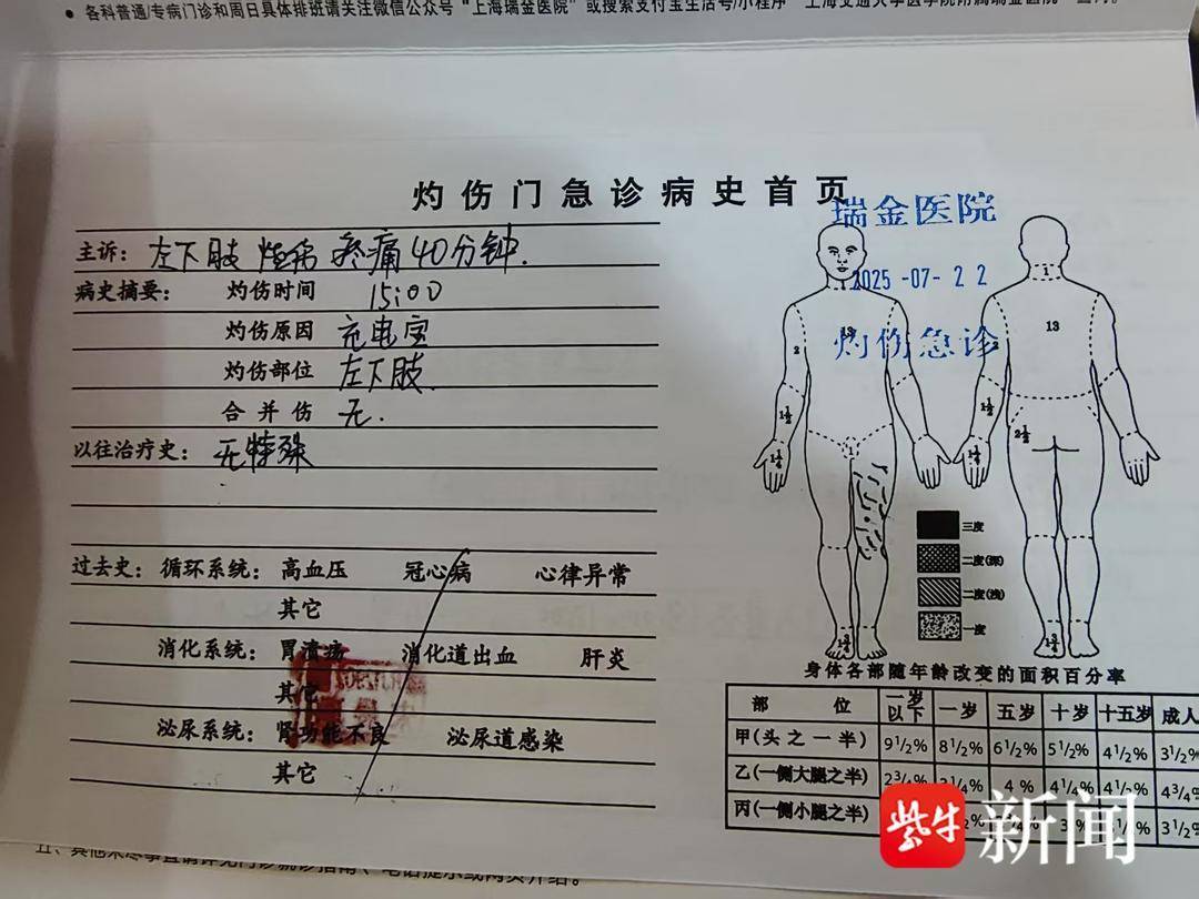 “罗马仕充电宝自燃烧伤腿部需植皮”<strong></p>
<p>okex现货</strong>，客服回应：正在核查此事