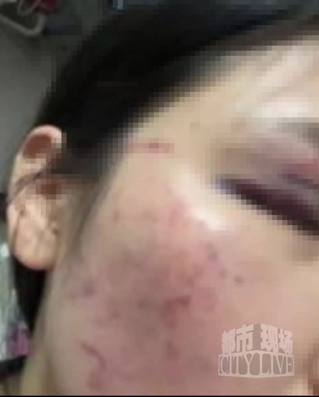湖南衡阳29岁女子疑被男友施暴后从25楼跳下身亡 男友徐某此前还刺激说：“你放心<strong></p>
<p>北交所合并</strong>，她不会去死的”