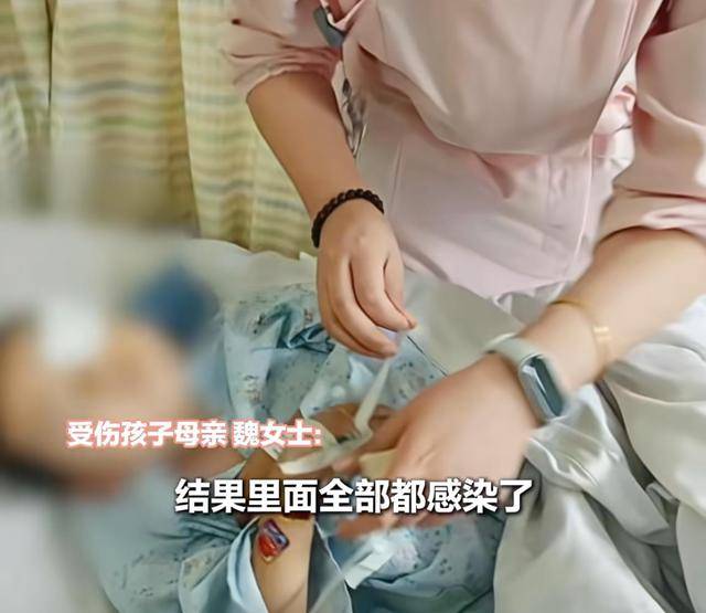 江西一5岁男孩在幼儿园被戳伤致左眼失明<strong></p>
<p>okex下载安卓版</strong>，家长称老师用猪油涂抹试图消肿