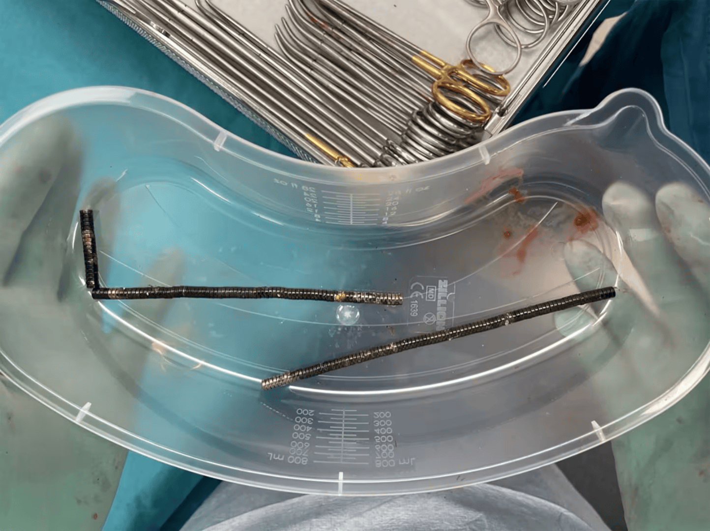 腹痛4天后送医<strong></p>
<p>okex交易平台app下载链接</strong>,新西兰男孩吞下约100颗磁铁致肠道坏死 医生切除部分肠组织